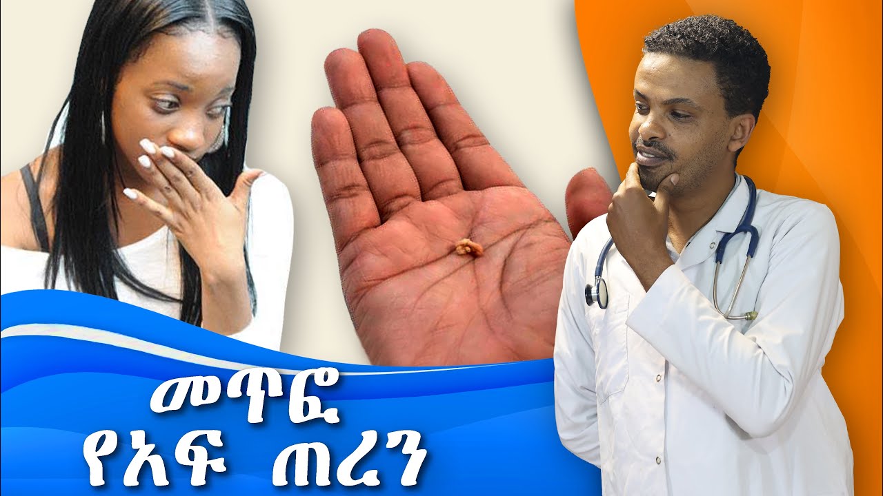 መጥፎ የአፍ ጠረን የሚያስከትሉ በሽታዎች እና ህክምናው | Bad breath, Halitosis | የአፍ ጠረን ለማጥፋት | Dr. Seife | ዶ/ር ሰይፈ