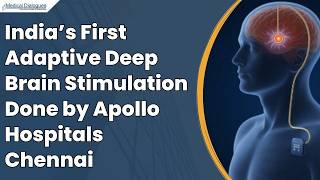 Apollo Hospitals Chennai Performs India’s First Adaptive Deep Brain Stimulation Procedure
