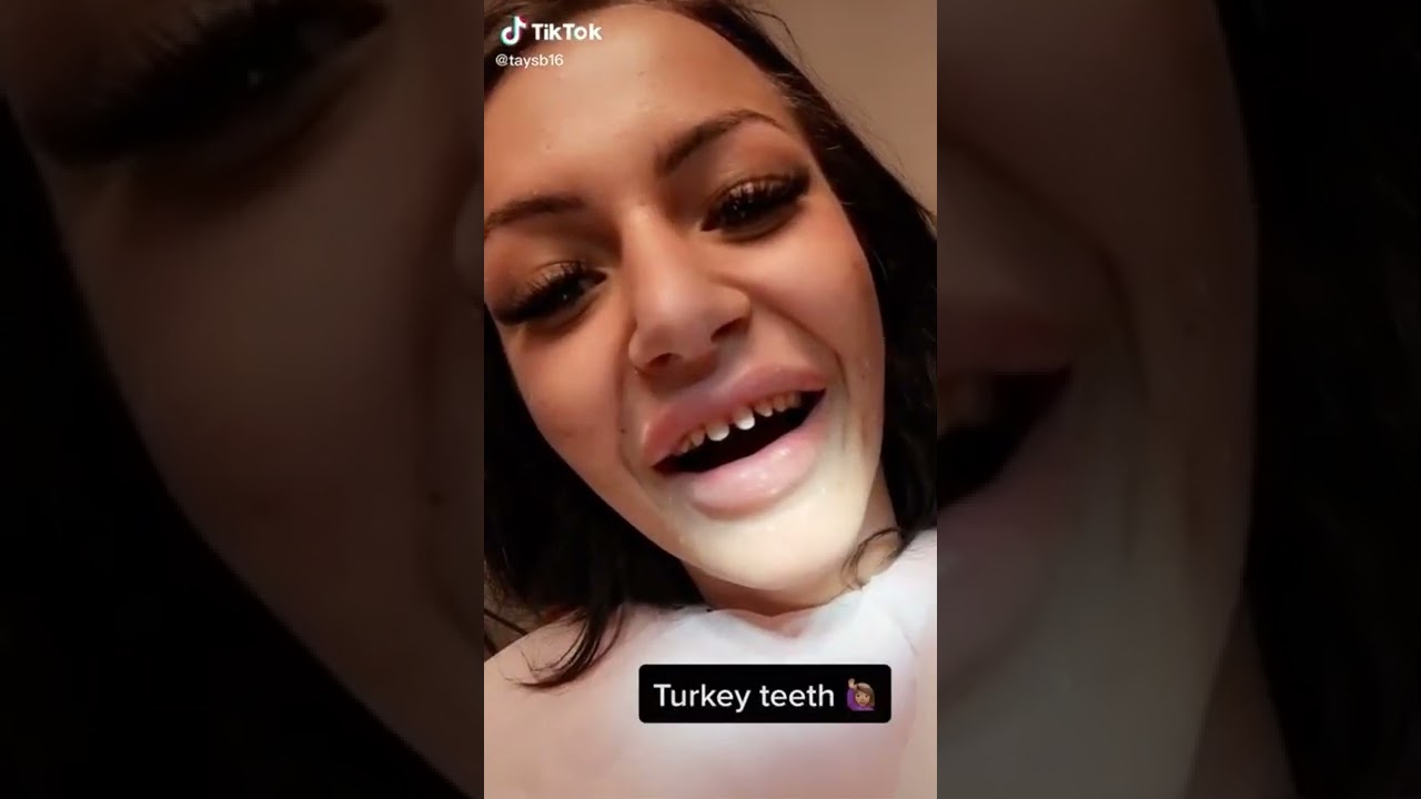 Thinking about Turkey Teeth? Think Again...