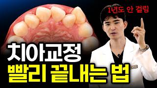 치아교정 빨리 끝내는 방법, 교정 시작 전 꼭 알아야 할 핵심