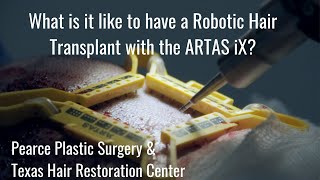 ARTAS iX Robotic Hair Restoration What is it like?