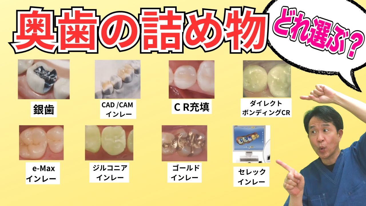 【インレー、詰め物8選】セラミック？銀歯？ジルコニア？　虫歯ができた時のおすすめ治療法｜歯医者が解説