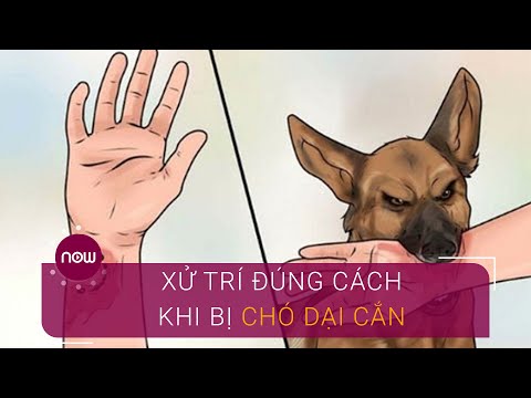 Chó Dại Cắn Có Chữa Được Không - Xử trí đúng cách khi bị chó dại cắn | VTC Now