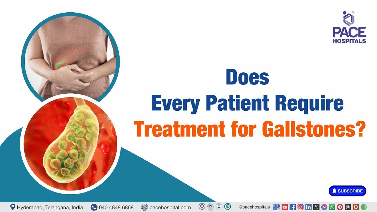 Does Every Patient Need Treatment for Gallstones? | Gallstone Treatment Guidelines 