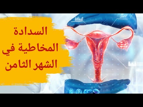 السدادة المخاطية في الشهر الثامن هل تنزل السدادة المخاطية في الثامن متى الولادة بعد نزول السدادة