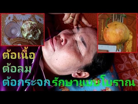 ตาเป็นต้อเนื้อ ต้อลม ต้อกระจก ! หยอดด้วยทับทบ ! รักษาแบบสมัยก่อน?