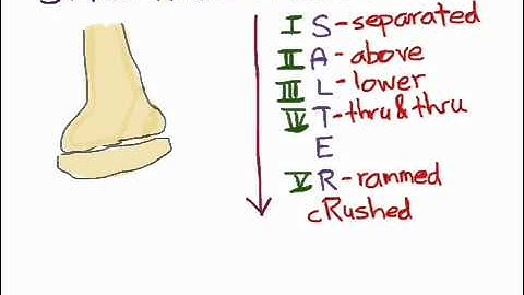 Salter-Harris Fractures