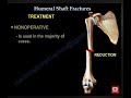 Humerus Fractures - Everything You Need To Know - Dr. Nabil Ebraheim