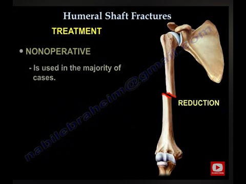 Video: Anatomi Tulang Humerus, Fungsi, Patah Tulang, Banyak Lagi