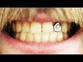 Кастомный зуб