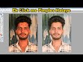 ek click me Pimples ko hataye | chahre se Pimples Daag dhabbe kaise hataye | Sk Photos