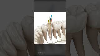What To Expect During a Root Canal, Is It Right For You?