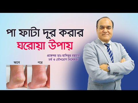 ভিডিও: পায়ের এভারটর কোন পেশী?