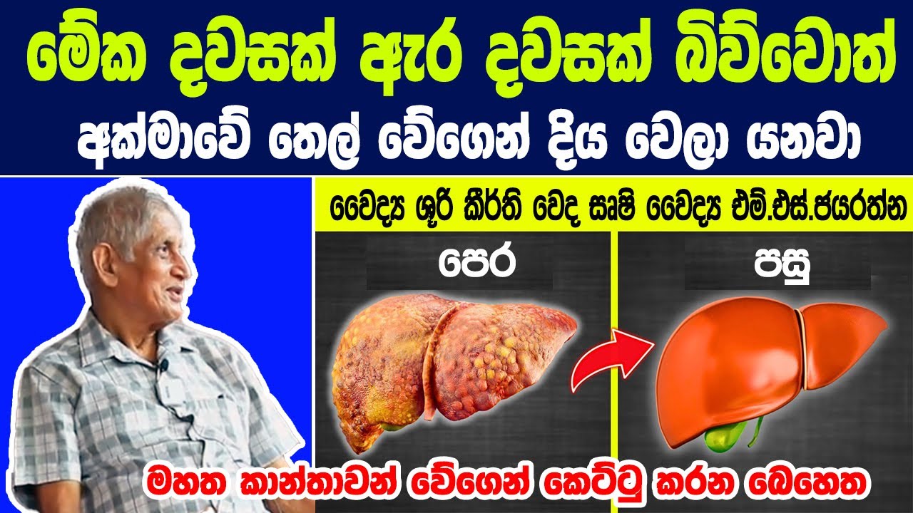 මහත කාන්තාවන් වේගෙන් කෙට්ටු කරන රහස් බෙහෙත ශ්‍රී හෙළ වෙද සෘෂි වෛද්‍ය එම්.එස්.ජයරත්න මහතා හෙළිකරයි !