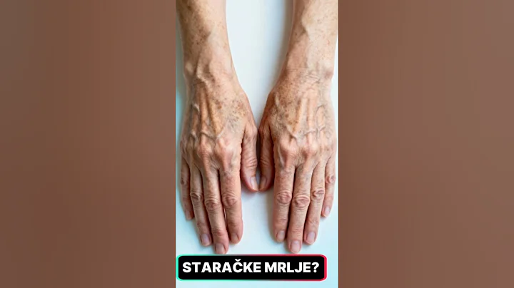 8 uzroka staračkih mrlja za koje većina ljudi nikada nije čula