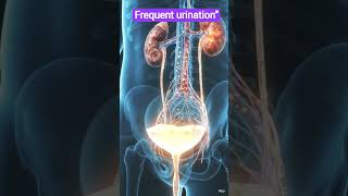 The Hidden Causes of Frequent Urination | Medical Animation#shorts#urineanalysis #youtube