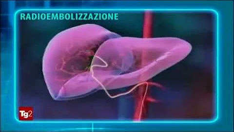 Quando si opera il fegato?