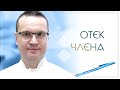 😲 Отек члена. Клинический случай №72