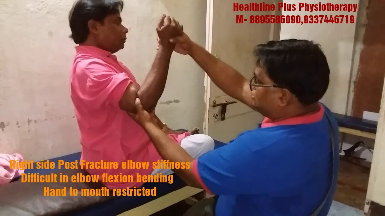 Right side post fracture|| elbow stiffness|| and difficult to bend# miracle recovery in HLPP#Dr Dey