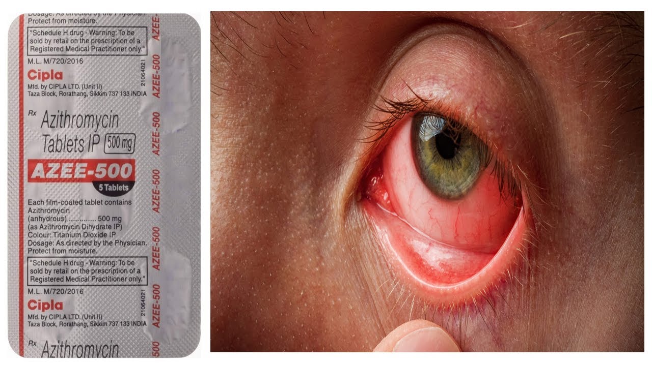 azithromycin 500mg 5 tablets