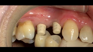 The Conometric Concept