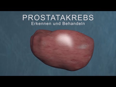 Prostatakrebs – Erkennen und Behandeln