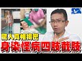 [鋼鐵教授] 爬山染怪病竟截四肢!? 何種病如此可怕? | 蒼藍鴿評評理EP18