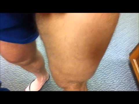 TLocke Update Front and Back Double Biceps, Legs and Calves