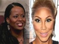 Celebrity who bleached their skin