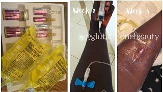 Glutathione Injection Whitening for black skin