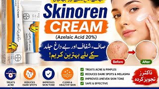 Skinoren Cream Uses, Benefits, Side Effects & How to Apply | Azelaic Acid 20%|Complete Guide in Urdu