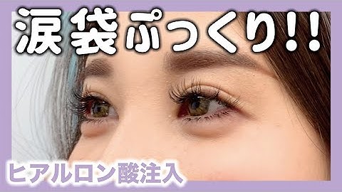 涙袋注射 Youtube