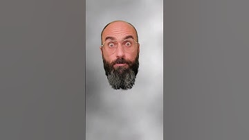 Some Surprising Eponyms