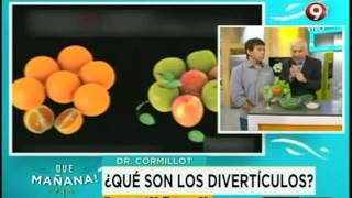 ¿Qué son los divertículos?