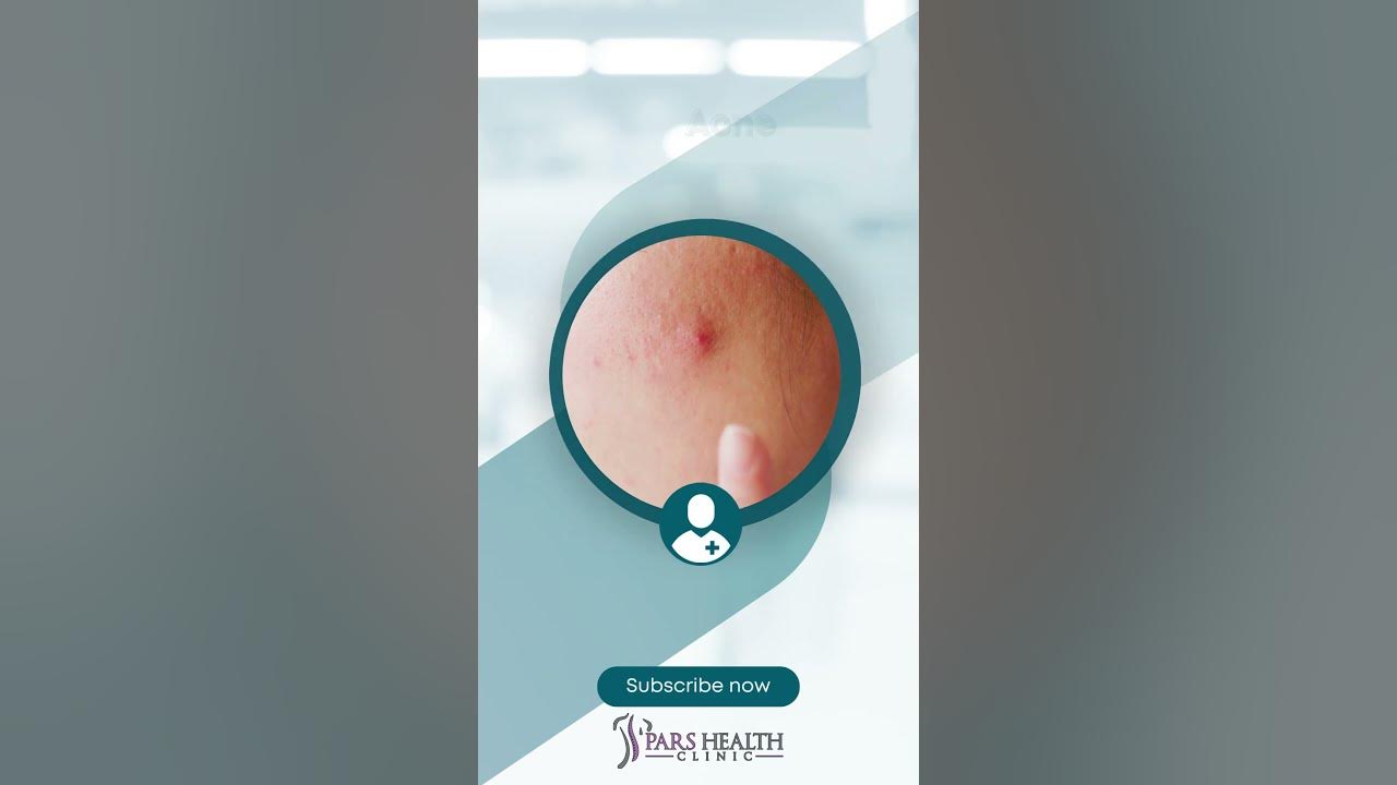 is-protein-powder-bad-for-you-acne-hair-loss-and-kidney-damage