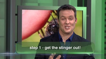 How to Remove Bee Stings