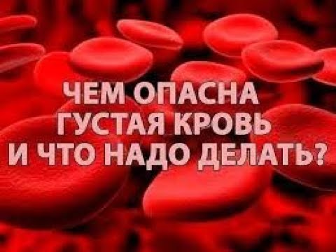 Видео: Полезните нематоди убиват ли калинките?