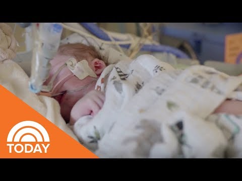 Video: Medfödd Stridor Hos Ett Barn. Vad är Det Och Hur Man Kan Hjälpa Till