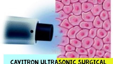 CAVITRON ULTRASONIC SURGICAL ASPIRATOR - CUSA