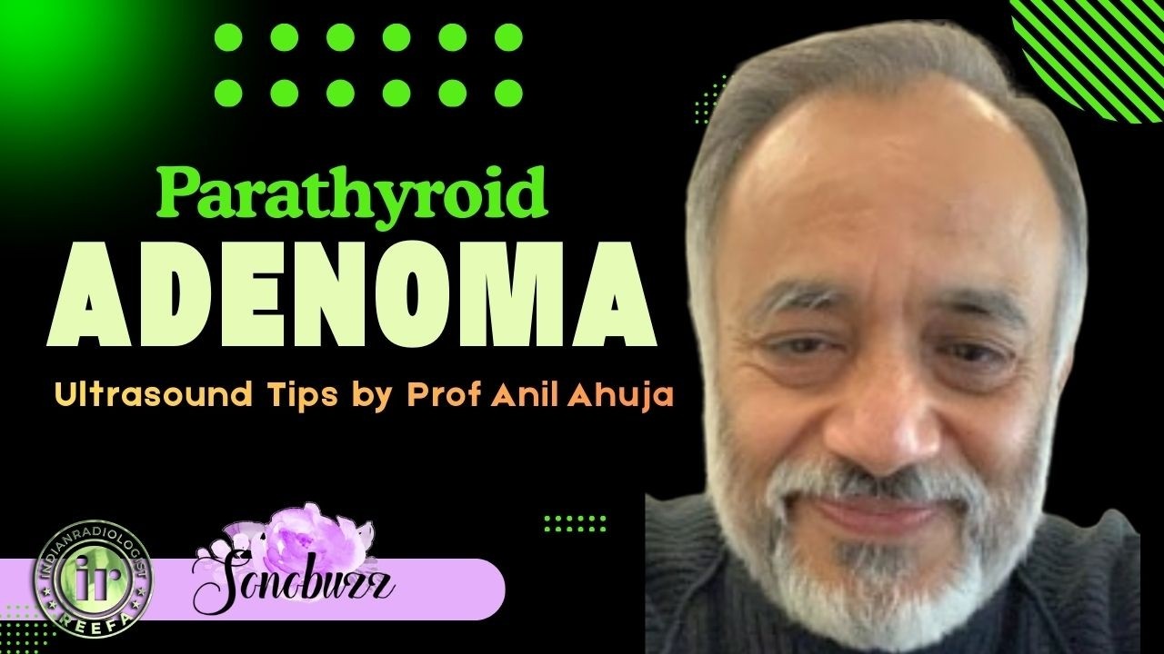 Доктор Анил Ахуджа | Аденома паращитовидной железы - советы по ультразвуковой диагностике для точ...