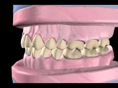 What is Orthodontics?