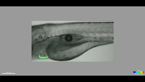 Cardiac contraction and circulation in a zebrafish larva