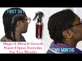 I can’t believe just two months 😲, miracle magic hair growth water for triple hair growth