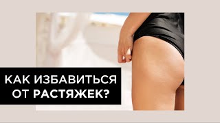 Как избавиться от растяжек? Продукты, которые реально работают | Kika-Style