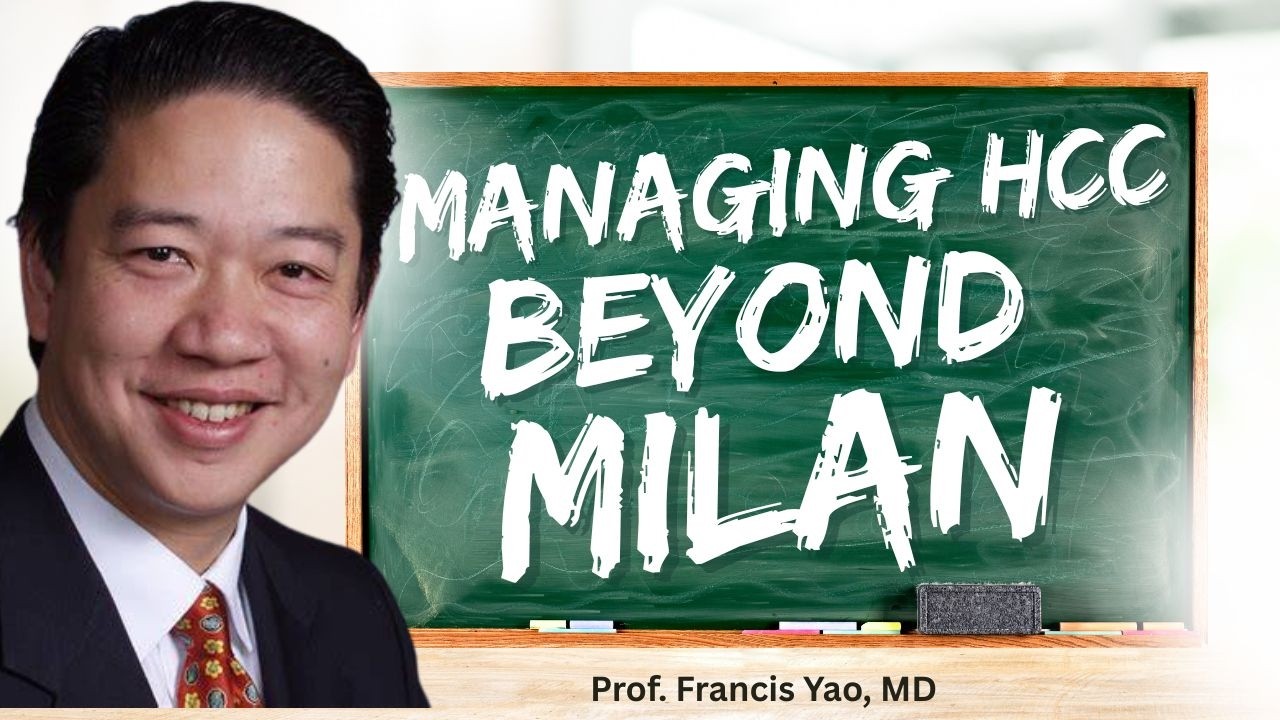Managing Hepatocellular Carcinoma Beyond MILAN criteria by Prof. Francis Yao, MD, FAASLD