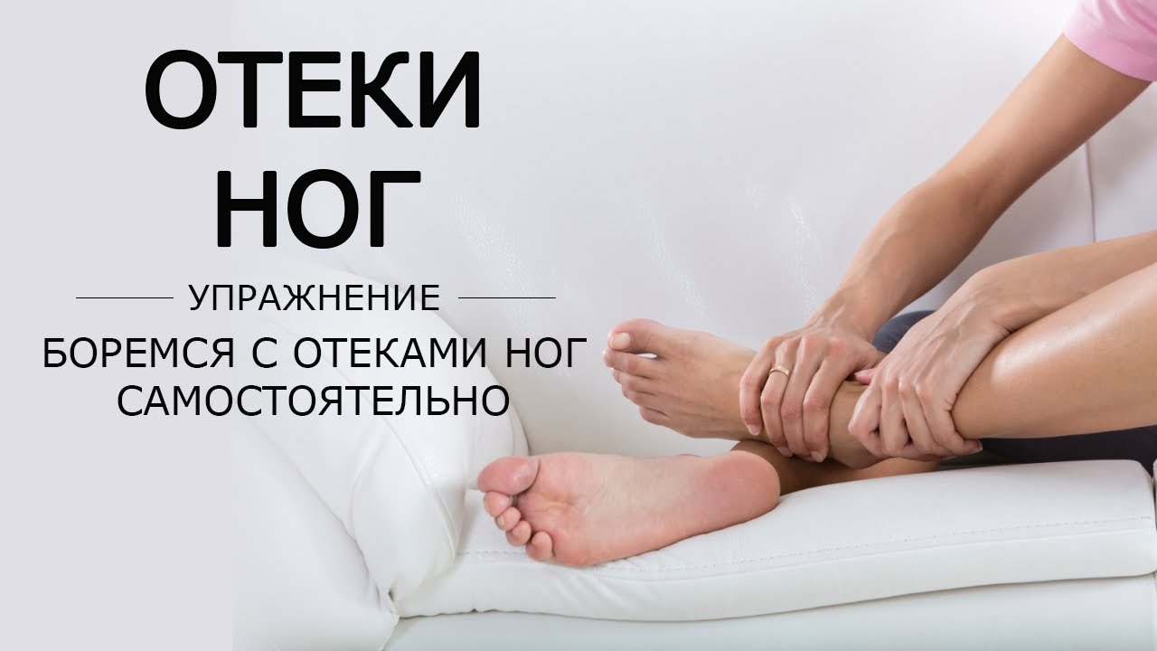 Отечность стоп ног