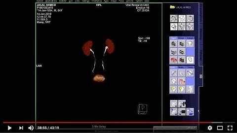 CT Urogram cutting & full work process