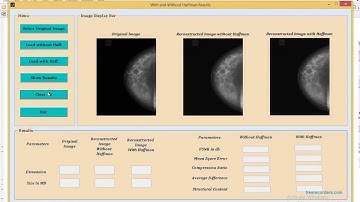 MATLAB code of medical Image compression using DWT - with and without Huffman encoding