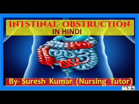 आंतों की रुकावट हिंदी में | INTESTINAL OBSTRUCTION IN HINDI