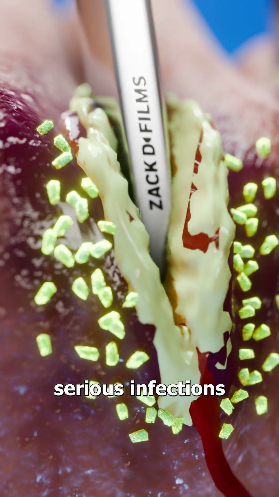 What If You Had Wolverine’s Claws? ?